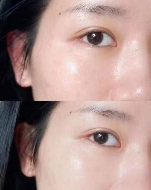 秦皇岛谷赞医疗美容诊所真人口碑评价怎么样？