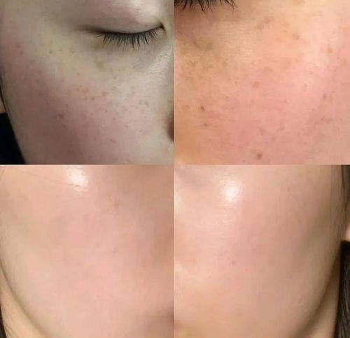 秦皇岛谷赞医疗美容诊所收费价格表/收费标准