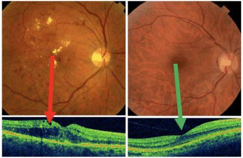 内蒙古民族大学附属医院眼科详细的预约挂号方式及流程