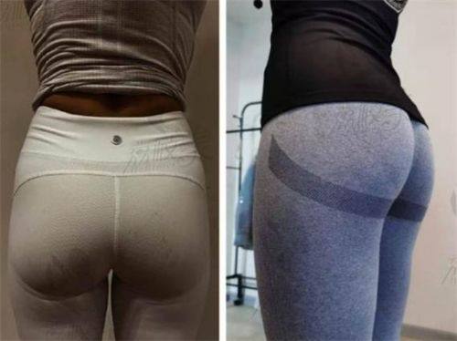 济南原纯医疗美容收费价格表/收费标准