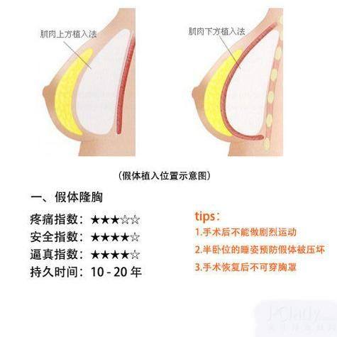 海南整形美容医院收费价格表/收费标准