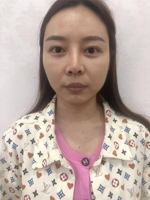 秦皇岛谷赞医疗美容诊所是正规医院吗？