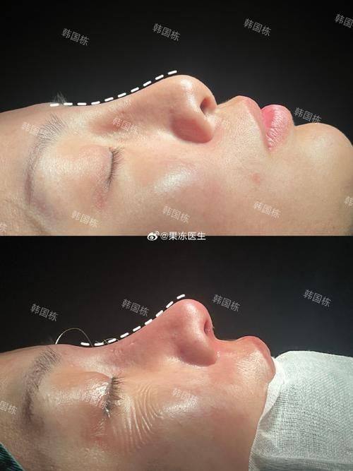 海南整形美容医院是正规医院吗？