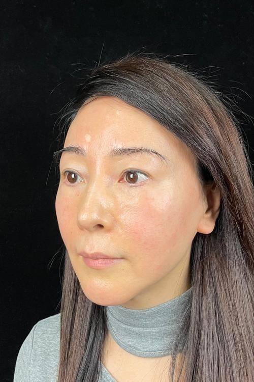 师宗县人民医院整形美容科是正规医院吗？