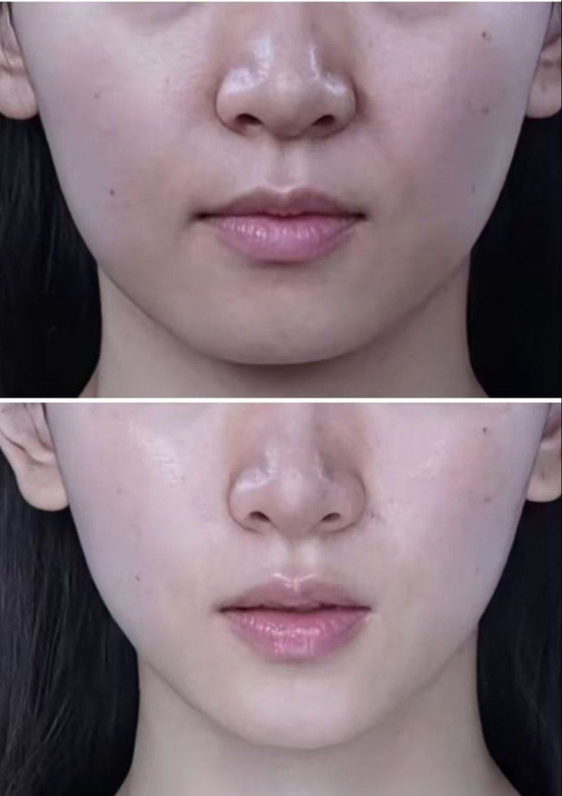 济南原纯医疗美容是正规医院吗？