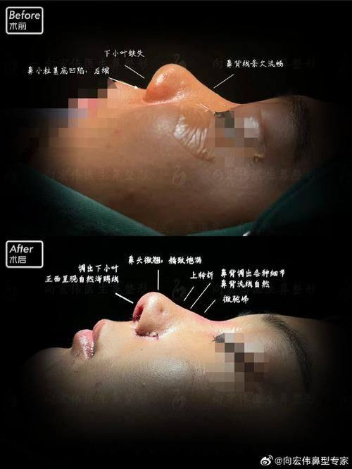 四川广元朗睿整形美容医院收费价格表/收费标准