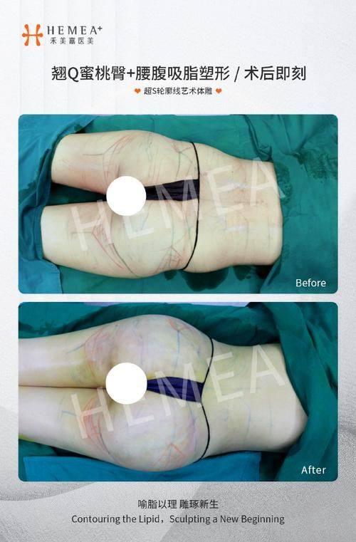 东莞君熠整形医院特色项目及技术优势