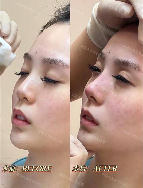 四川广元朗睿整形美容医院特色项目及技术优势