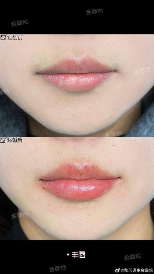 泉州阳光纯韩整形特色项目及技术优势