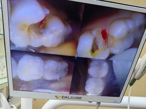 西安雁塔天瑞口腔门诊部收费价格表/收费标准