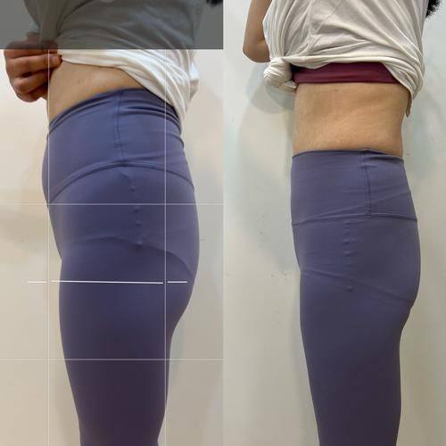 四川广元朗睿整形美容医院真人口碑评价怎么样？