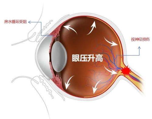 镇雄视康眼科医院特色项目及技术优势