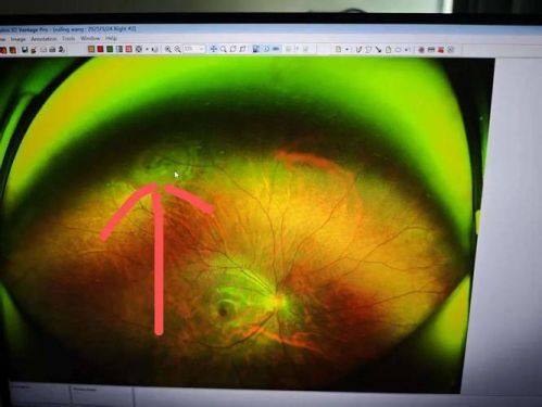 肃宁建勋眼科诊所地址电话营业时间