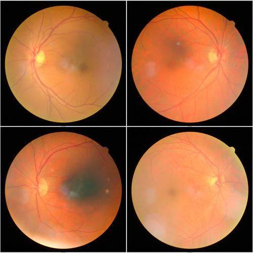 肃宁建勋眼科诊所详细的预约挂号方式及流程