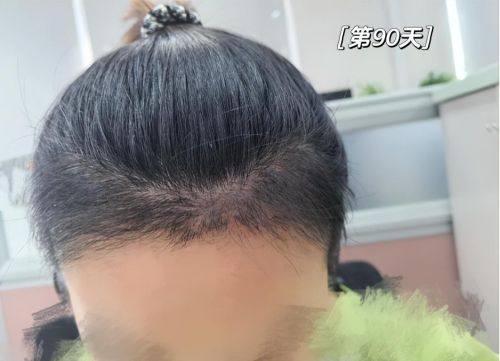 厦门黄岩整形美容门诊部特色项目及技术优势