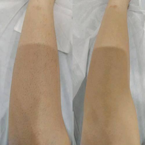 泉州阳光纯韩整形地址电话营业时间