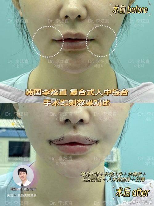 厦门黄岩整形美容门诊部真人口碑评价怎么样？