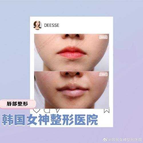 重庆格林医院医疗美容科真人口碑评价怎么样？