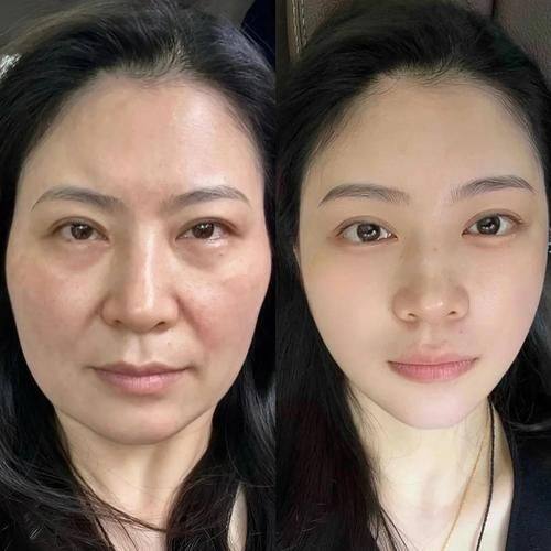 东莞君熠整形医院是正规医院吗？