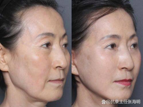 泉州阳光纯韩整形详细的预约挂号方式及流程