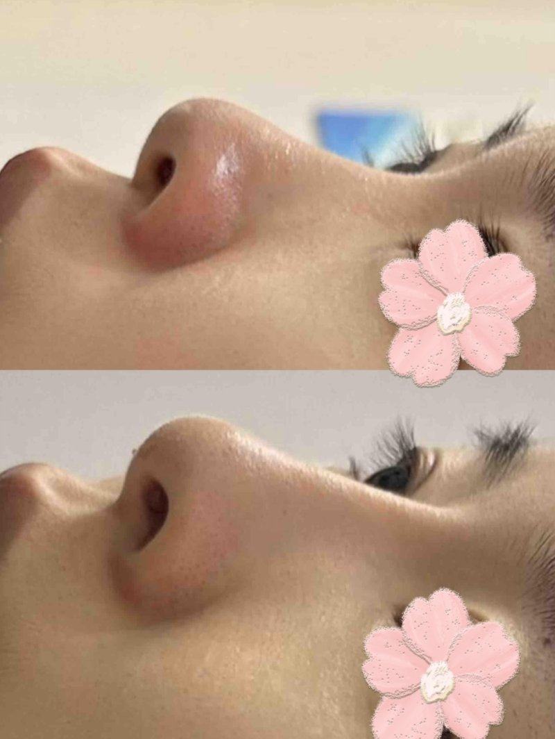 四川广元朗睿整形美容医院详细的预约挂号方式及流程