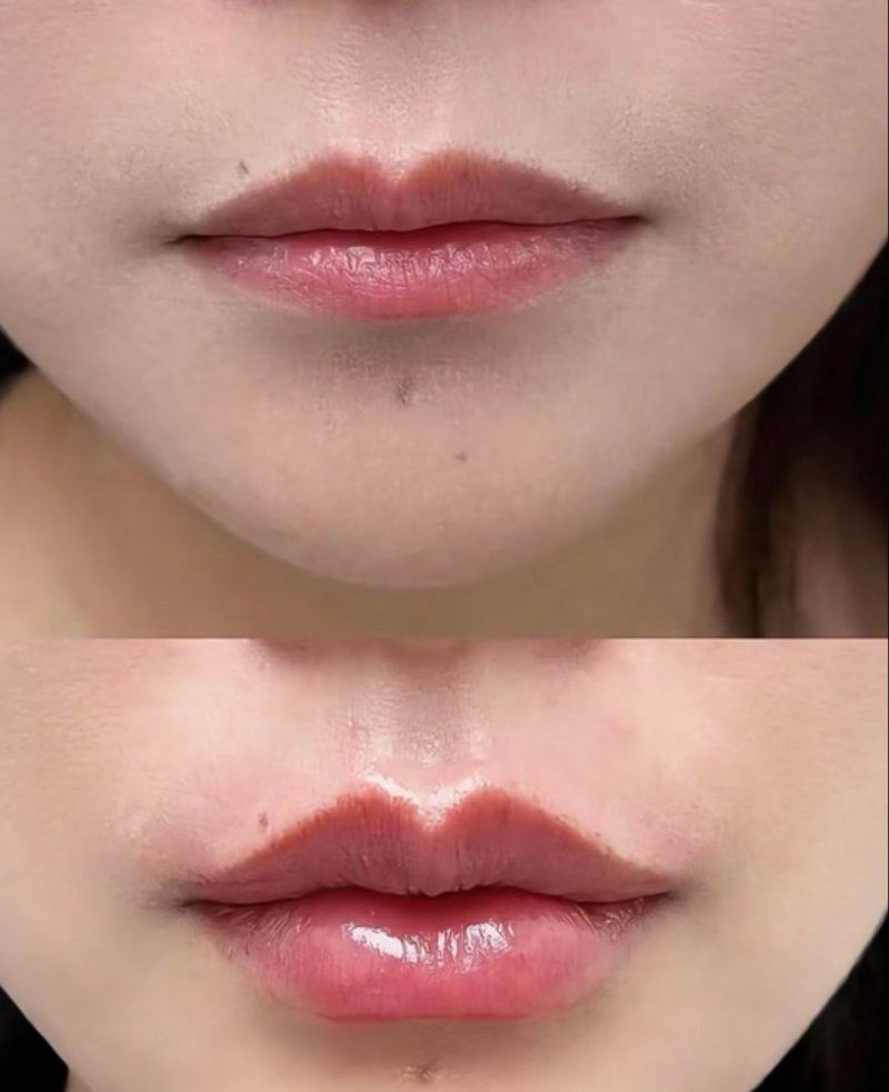 泉州阳光纯韩整形收费价格表/收费标准