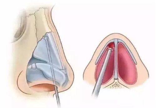 漳州芗城柏思娅医疗美容门诊部特色项目及技术优势