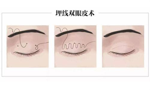 桐城德尔美客医疗美容门诊部收费价格表/收费标准