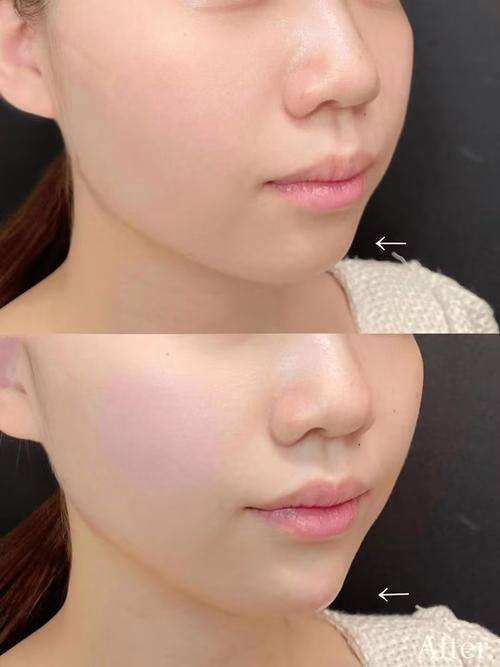 成都亚鑫时尚医美诊所特色项目及技术优势