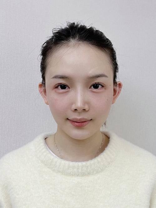 成都亚鑫时尚医美诊所收费价格表/收费标准