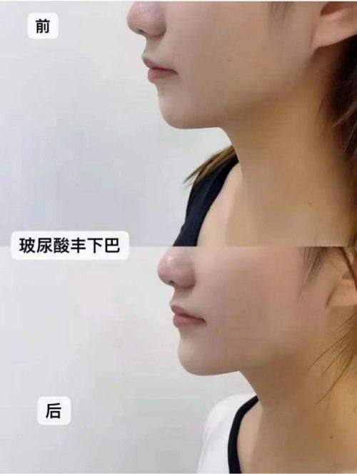 成都亚鑫时尚医美诊所是正规医院吗?