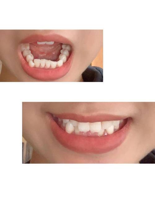 平凉段崇义口腔门诊部特色项目及技术优势