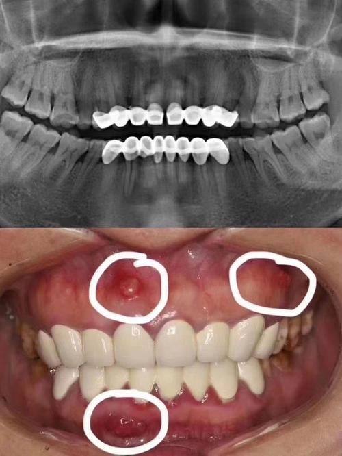 安徽亳州丽齿口腔真人口碑评价怎么样?