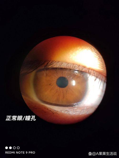 邯郸市中 心医院眼科医生团队实力强大及骨干医生简介