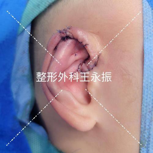 上海第六人民医院金山分院整形美容外科真人口碑评价怎么样?