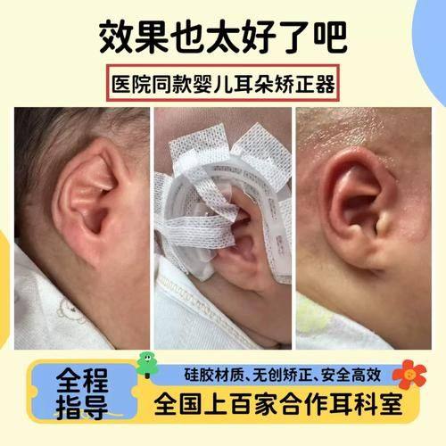 上海第六人民医院金山分院整形美容外科是正规医院吗?