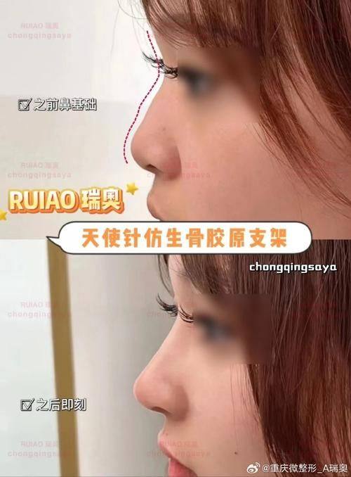 漳州芗城柏思娅医疗美容门诊部收费价格表/收费标准