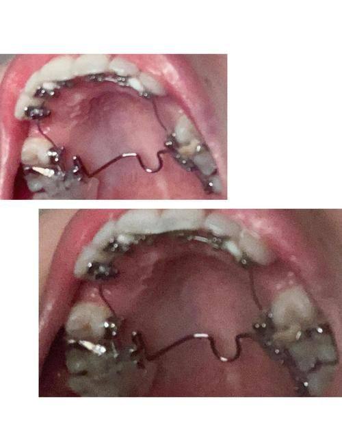 上海精诚口腔门诊部收费价格表/收费标准