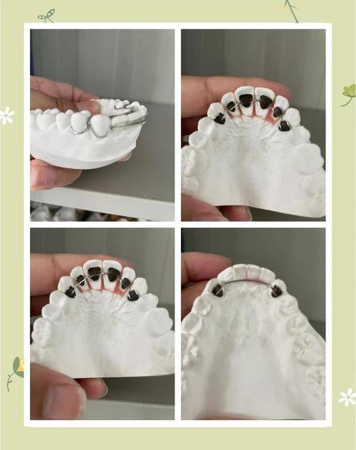 上海精诚口腔门诊部详细的预约挂号方式及流程