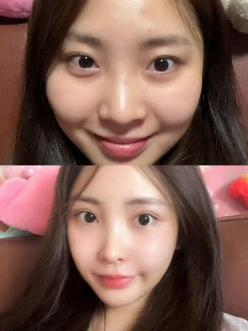 成都绿叶爱丽美妇产科医院医疗整形美容科收费价格表/收费标准