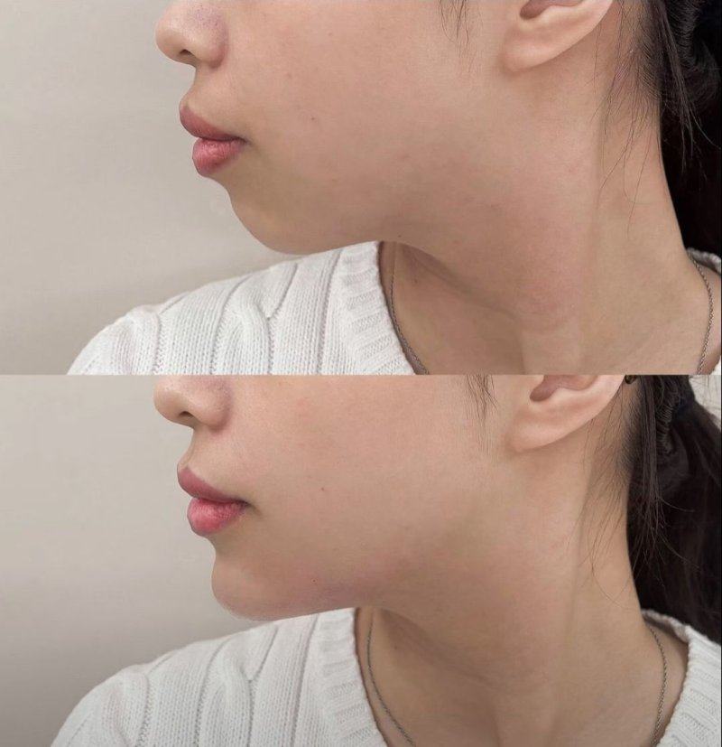 桐城德尔美客医疗美容门诊部详细的预约挂号方式及流程