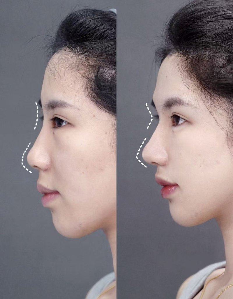 北京光泽明颜整形医疗美容诊所真人口碑评价怎么样？