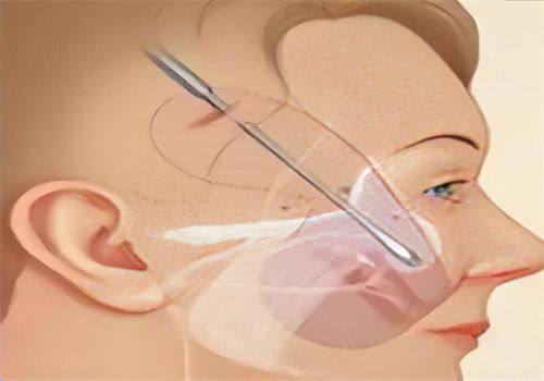 兴隆县天佑医院整形美容科收费价格表/收费标准