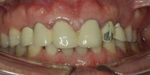 广东广州如壹齿科是正规医院吗?