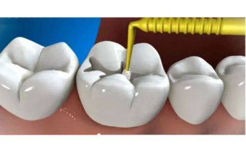 无锡雅贝佳口腔地址电话营业时间