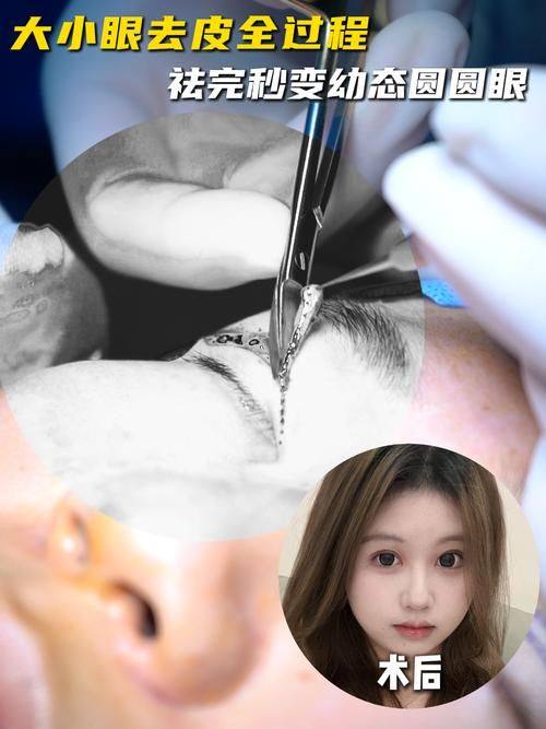 兴隆县天佑医院整形美容科医生团队实力强大及骨干医生简介