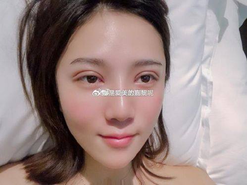 兴隆县天佑医院整形美容科特色项目及技术优势