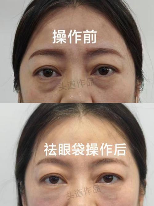 王佑兴医生口碑评价及真人实例