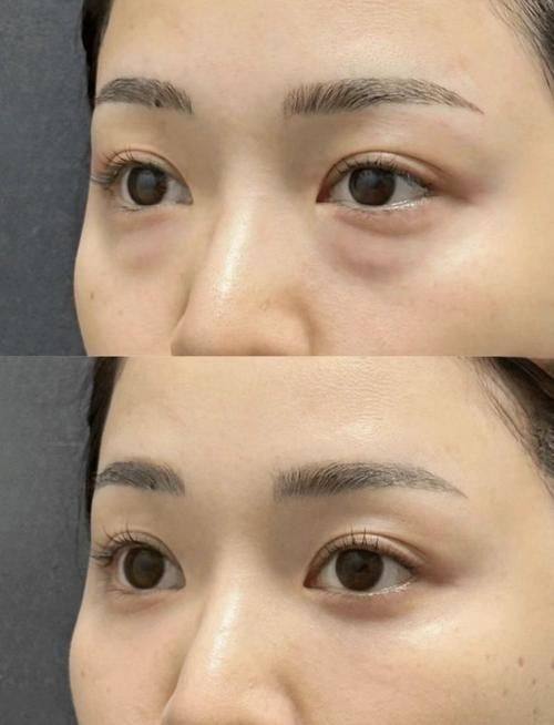 王佑兴医生价格表