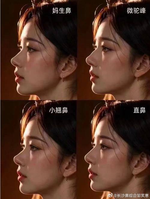 王佑兴医生口碑评价及真人实例